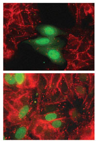  הביטוי של הגן "סלאג" בתאים סרטניים של המעי (תאים הצבועים בירוק בתמונה העליונה) גרם לדיכוי הביטוי של קדהרין-אי בתאים אלה (שלא נצבעו באדום) ולשינוי בולט בצורתם. לעומת זאת, הביטוי של חלבון אחר (היסטון, ששימש כביקורת, בתמונה התחתונה) בגרעיני התאים לא גרם לשינוי כלשהו בצורת התא או ברמת הקדהרין -אי (ולכן הם נצבעו באדום)
